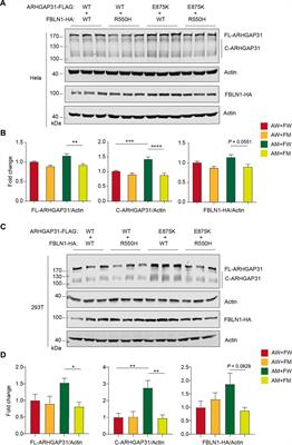 Synergistic effects of rare variants of ARHGAP31 and FBLN1 in vitro in terminal transverse limb defects